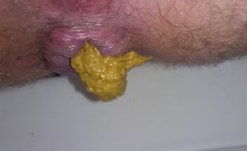 Teen boy shitting yellow crap in very close up