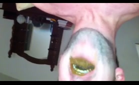 Chick Takes a Crap on Her Infected Wound