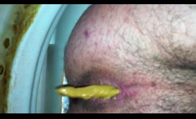 Man Gets Shit on His Asshole