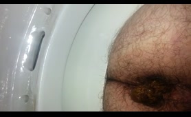 Hairy guy craps something nasty