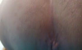 Yellow poop in close up